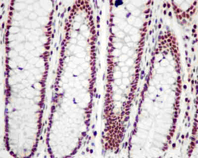 Immunohistochemistry (Formalin/PFA-fixed paraffin-embedded sections) - Anti-PREB antibody [EPR13252] - BSA and Azide free (AB250431), expandable thumbnail