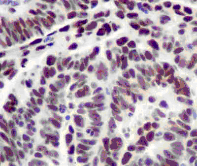 Immunohistochemistry (Formalin/PFA-fixed paraffin-embedded sections) - Anti-PREB antibody [EPR13252] - BSA and Azide free (AB250431), expandable thumbnail