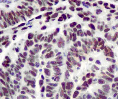Immunohistochemistry (Formalin/PFA-fixed paraffin-embedded sections) - Anti-PREB antibody [EPR13252] - BSA and Azide free (AB250431)