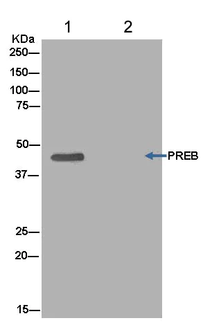 Immunoprecipitation - Anti-PREB antibody [EPR13252] - BSA and Azide free (AB250431)