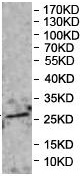 Western blot - Anti-PRELID1 antibody (AB196275)