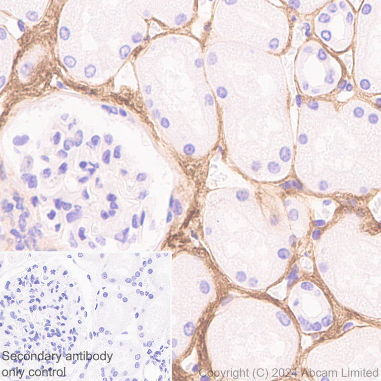 Immunohistochemistry (Formalin/PFA-fixed paraffin-embedded sections) - Anti-PRELP antibody [EPR29393-568] - BSA and Azide free (AB324769)