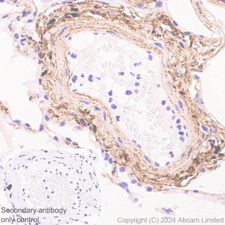 Immunohistochemistry (Formalin/PFA-fixed paraffin-embedded sections) - Anti-PRELP antibody [EPR29393-568] - BSA and Azide free (AB324769)