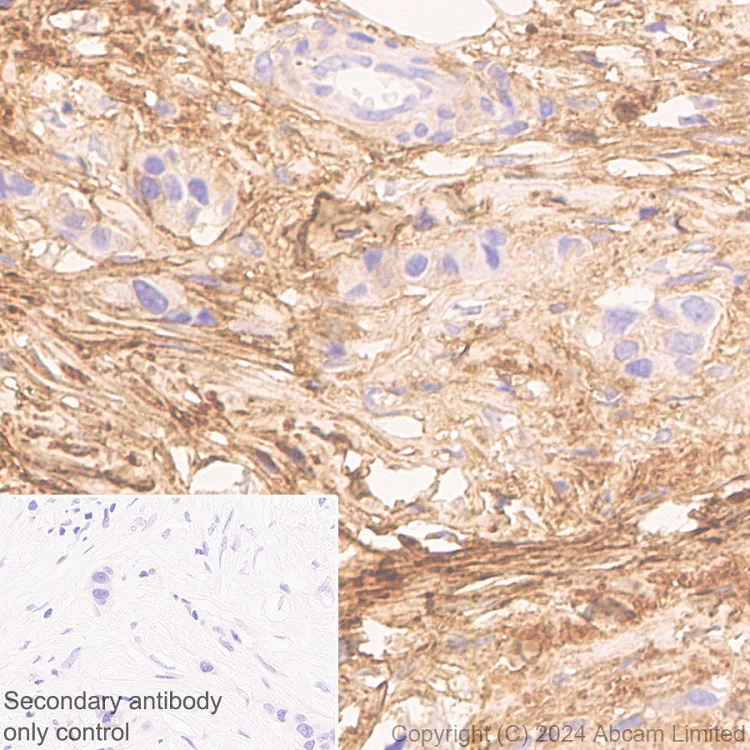 Immunohistochemistry (Formalin/PFA-fixed paraffin-embedded sections) - Anti-PRELP antibody [EPR29393-568] - BSA and Azide free (AB324769)