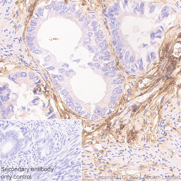 Immunohistochemistry (Formalin/PFA-fixed paraffin-embedded sections) - Anti-PRELP antibody [EPR29393-568] - BSA and Azide free (AB324769)
