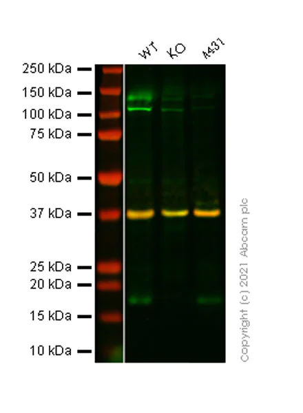 Western blot - Anti-Presenilin 1/PS-1 antibody [5E12] - BSA and Azide free (AB255850)