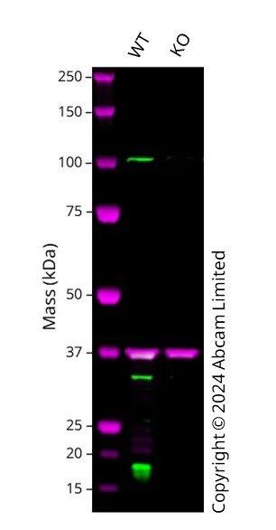 Western blot - Anti-Presenilin 1/PS-1 antibody [5E12] - BSA and Azide free (AB255850)