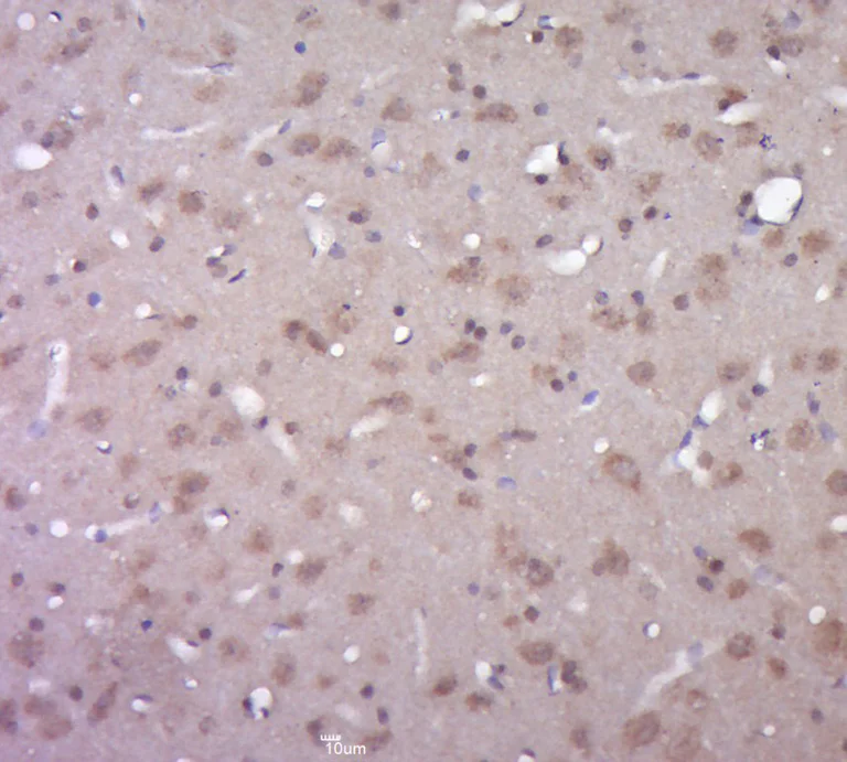 Immunohistochemistry (Formalin/PFA-fixed paraffin-embedded sections) - Anti-Presenilin 1/PS-1 antibody (AB216400)