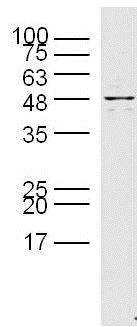 Western blot - Anti-Presenilin 1/PS-1 antibody (AB216400)