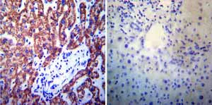 Immunohistochemistry (Formalin/PFA-fixed paraffin-embedded sections) - Anti-Presenilin 1/PS-1 antibody [APS 11] (AB15456)