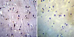 Immunohistochemistry (Formalin/PFA-fixed paraffin-embedded sections) - Anti-Presenilin 1/PS-1 antibody [APS 11] (AB15456)