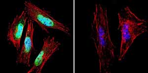 Immunocytochemistry/ Immunofluorescence - Anti-Presenilin 1/PS-1 antibody [APS 18] (AB15458), expandable thumbnail