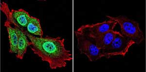 Immunocytochemistry/ Immunofluorescence - Anti-Presenilin 1/PS-1 antibody [APS 18] (AB15458), expandable thumbnail
