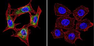 Immunocytochemistry/ Immunofluorescence - Anti-Presenilin 1/PS-1 antibody [APS 18] (AB15458), expandable thumbnail