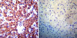 Immunohistochemistry (Formalin/PFA-fixed paraffin-embedded sections) - Anti-Presenilin 1/PS-1 antibody [APS 18] (AB15458), expandable thumbnail
