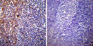 Immunohistochemistry (Formalin/PFA-fixed paraffin-embedded sections) - Anti-Presenilin 1/PS-1 antibody [APS 18] (ab15458), expandable thumbnail