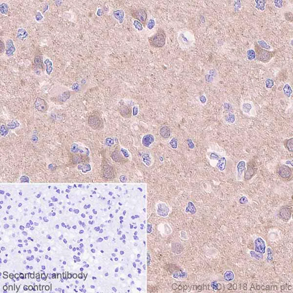 Immunohistochemistry (Formalin/PFA-fixed paraffin-embedded sections) - Anti-Presenilin 1/PS-1 antibody [EP2000Y] (AB76083)