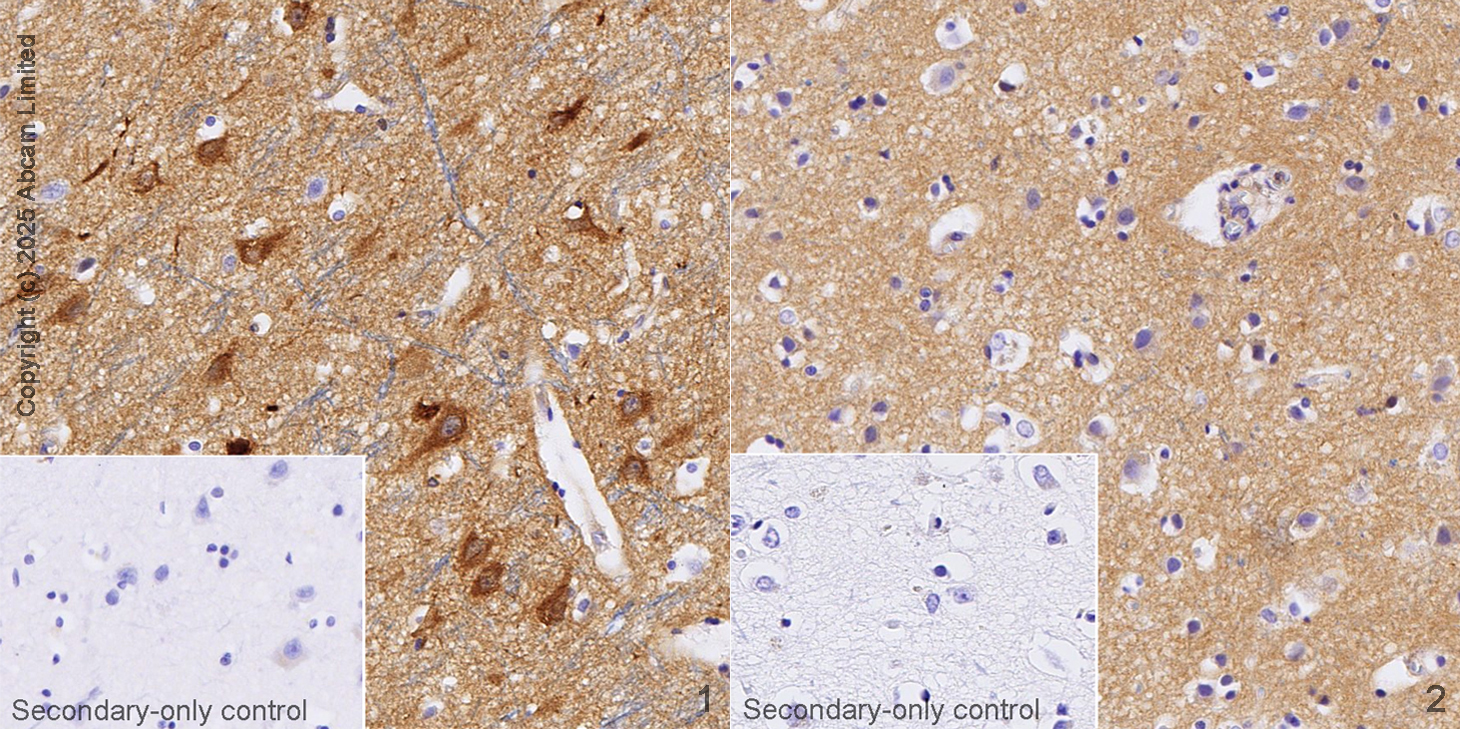 Immunohistochemistry (Formalin/PFA-fixed paraffin-embedded sections) - Anti-Presenilin 1/PS-1 antibody [EP2000Y] (AB76083)