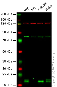 Western blot - Anti-Presenilin 1/PS-1 antibody [EP2000Y] (AB76083)