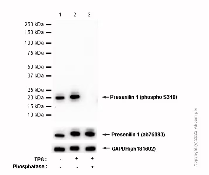 Western blot - Anti-Presenilin 1/PS-1 (phospho S310) antibody [EP2001Y] (AB76131), expandable thumbnail