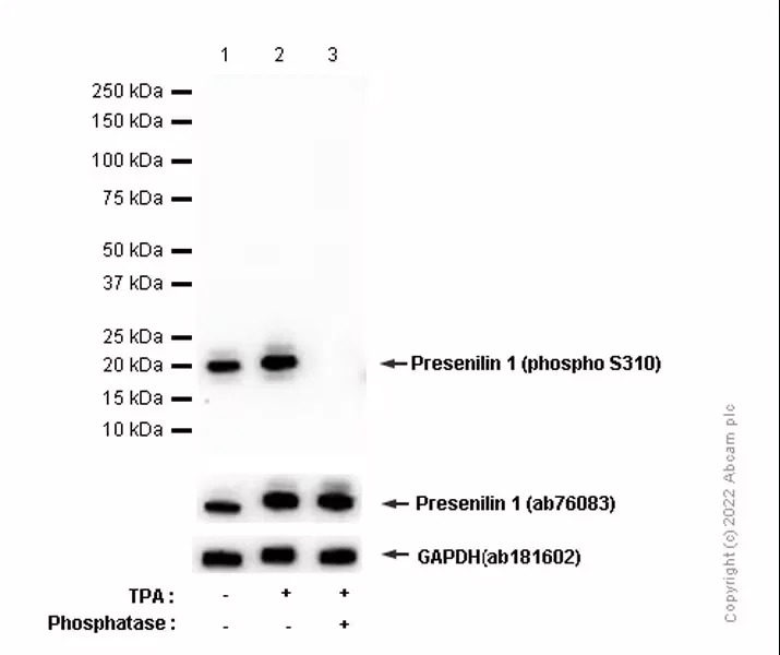 Western blot - Anti-Presenilin 1/PS-1 (phospho S310) antibody [EP2001Y] - BSA and Azide free (AB284745)