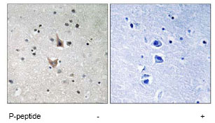 Immunohistochemistry (Formalin/PFA-fixed paraffin-embedded sections) - Anti-Presenilin 1/PS-1 (phospho S357) antibody (AB78914)