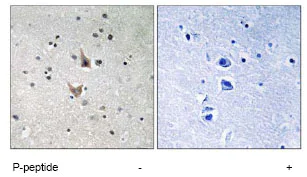 Immunohistochemistry (Formalin/PFA-fixed paraffin-embedded sections) - Anti-Presenilin 1/PS-1 (phospho S357) antibody (AB78914)