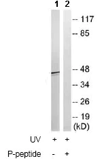 Western blot - Anti-Presenilin 1/PS-1 (phospho S357) antibody (AB78914)