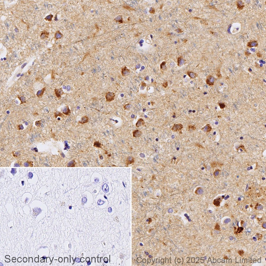 Anti-Presenilin 2/AD5 antibody [EP1515Y] (ab51249) | Abcam