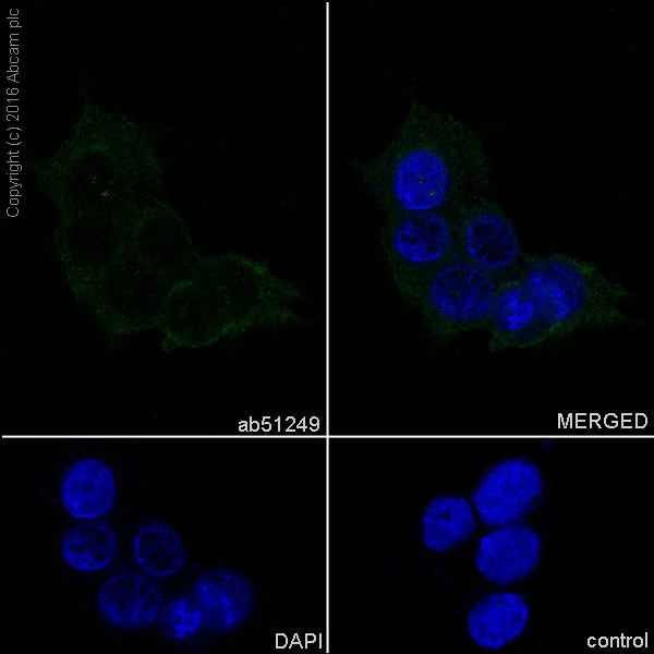 Immunocytochemistry/ Immunofluorescence - Anti-Presenilin 2/AD5 antibody [EP1515Y] - BSA and Azide free (AB239841)