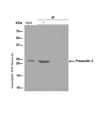 Immunoprecipitation - Anti-Presenilin 2/AD5 antibody [EP1515Y] - BSA and Azide free (AB239841)