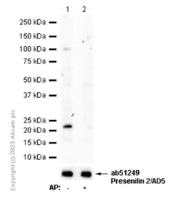 Western blot - Anti-Presenilin 2/AD5 (phospho S327) antibody [EP2613Y] (AB76114)