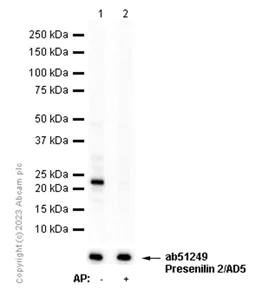 Western blot - Anti-Presenilin 2/AD5 (phospho S327) antibody [EP2613Y] - BSA and Azide free (AB284741)