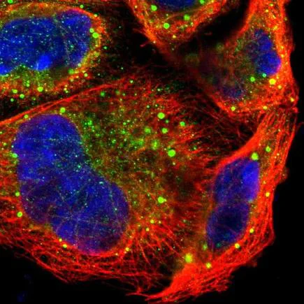 Immunocytochemistry/ Immunofluorescence - Anti-PREX1 antibody (AB223698)