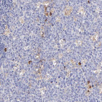 Immunohistochemistry (Formalin/PFA-fixed paraffin-embedded sections) - Anti-PREX1 antibody (AB223698)