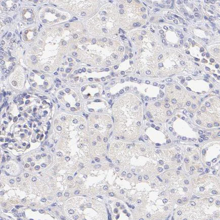 Immunohistochemistry (Formalin/PFA-fixed paraffin-embedded sections) - Anti-PREX1 antibody (AB223698)