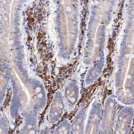Immunohistochemistry (Formalin/PFA-fixed paraffin-embedded sections) - Anti-PREX1 antibody (AB223698)