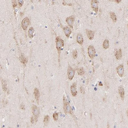 Immunohistochemistry (Formalin/PFA-fixed paraffin-embedded sections) - Anti-PREX1 antibody (AB223698)