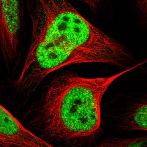 Immunocytochemistry/ Immunofluorescence - Anti-PREX2 antibody (AB121462)