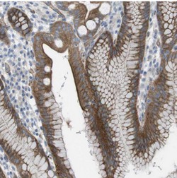 Immunohistochemistry (Formalin/PFA-fixed paraffin-embedded sections) - Anti-PREX2 antibody (AB121462)
