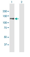 Western blot - Anti-PREX2 antibody (AB169027), expandable thumbnail