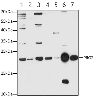 Western blot - Anti-PRG2 antibody (AB187523)