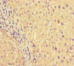 Immunohistochemistry (Formalin/PFA-fixed paraffin-embedded sections) - Anti-PRG2 antibody (AB236851)