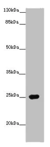 Western blot - Anti-PRG2 antibody (AB236851)