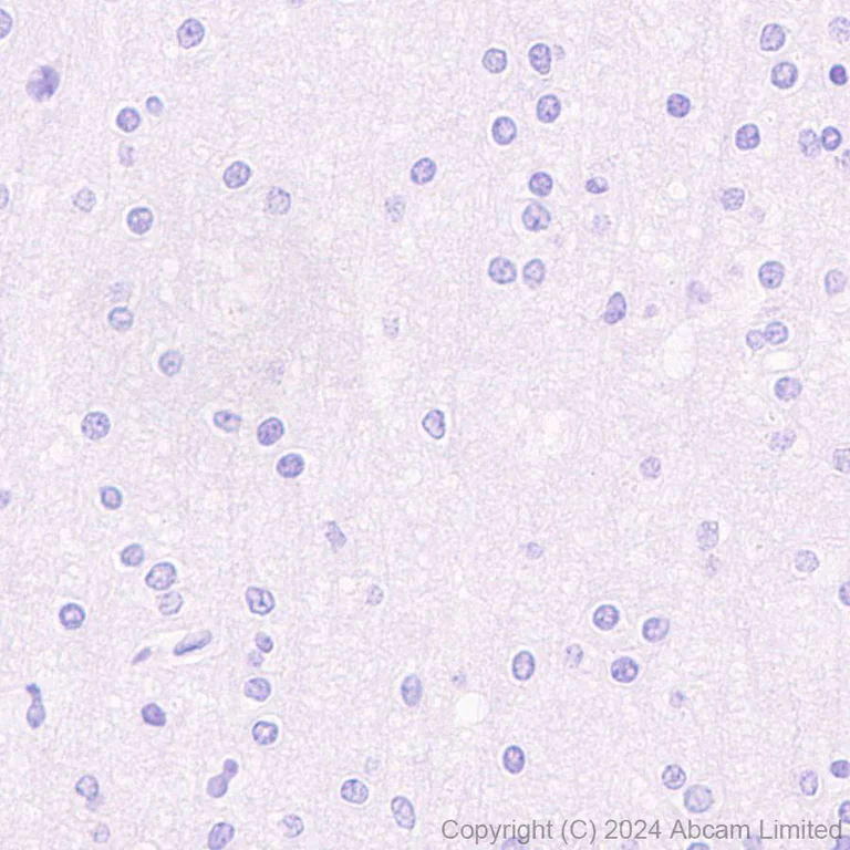 Immunohistochemistry (Formalin/PFA-fixed paraffin-embedded sections) - Anti-PRG2 antibody [EPR29096-502] - BSA and Azide free (AB324771)