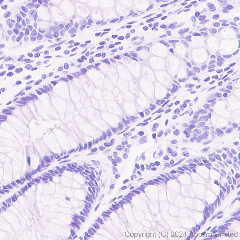 Immunohistochemistry (Formalin/PFA-fixed paraffin-embedded sections) - Anti-PRG2 antibody [EPR29096-502] - BSA and Azide free (AB324771)