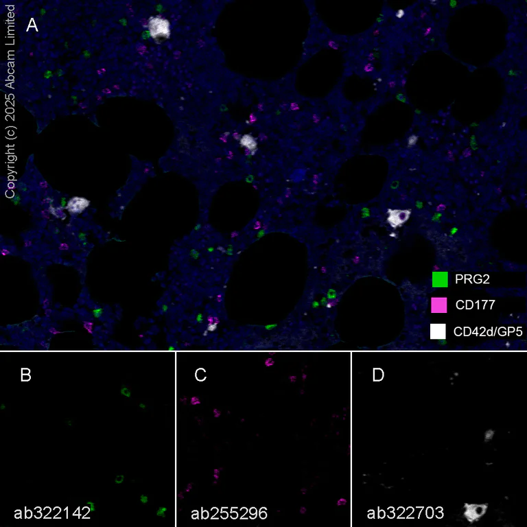 Multiplex immunohistochemistry - Anti-PRG2 antibody [EPR29096-502] - BSA and Azide free (AB324771)