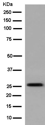 Western blot - Anti-PRG3 antibody [EPR13990] (AB182142)