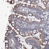 Immunohistochemistry (Formalin/PFA-fixed paraffin-embedded sections) - Anti-PRHOXNB antibody (AB122523)