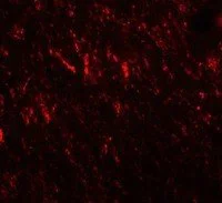 Immunocytochemistry/ Immunofluorescence - Anti-Prickle 2 antibody (AB211419)